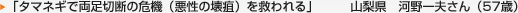 ｢タマネギで両足切断の危機（悪性の壊疽）を救われる」 山梨県   河野一夫さん（57歳）